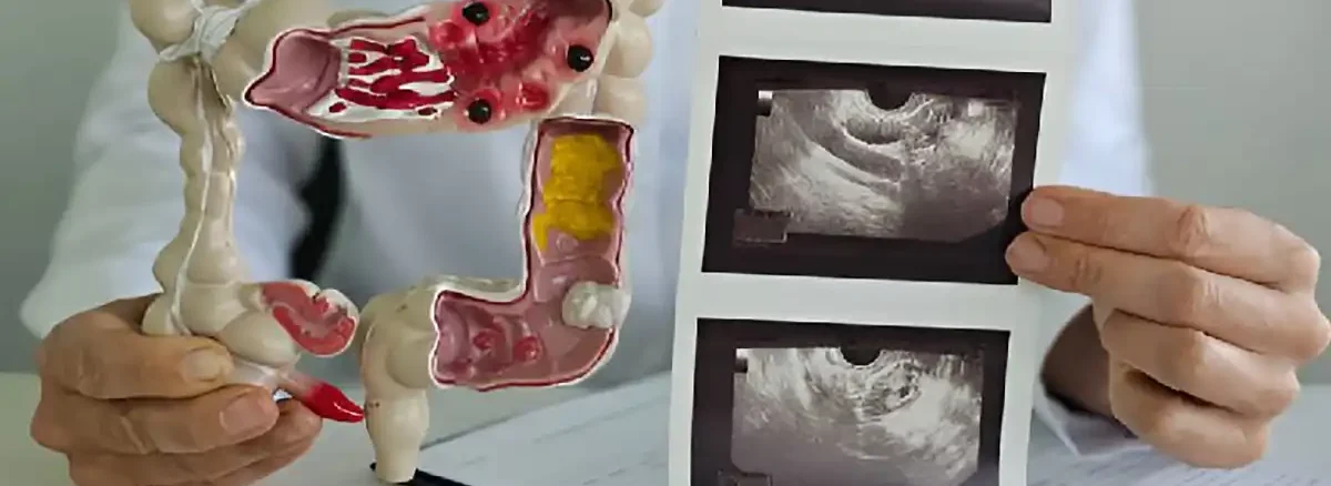 آندوسکوپی چیست و چگونه انجام می شود