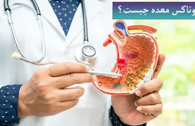 بوتاکس معده چیست و چه نتایجی دارد؟
