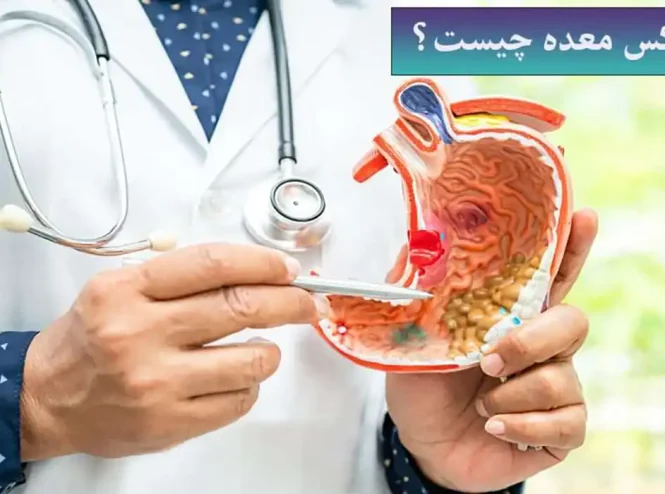 بوتاکس معده چیست و چه نتایجی دارد؟