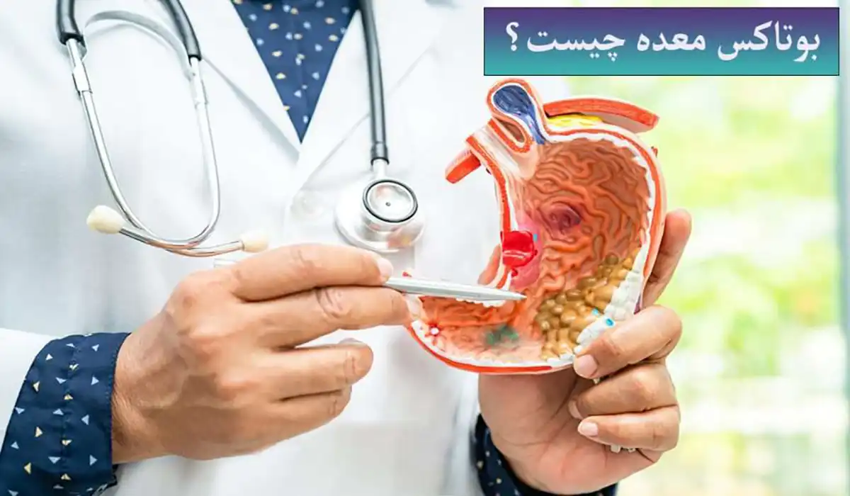 بوتاکس معده چیست و چه نتایجی دارد؟