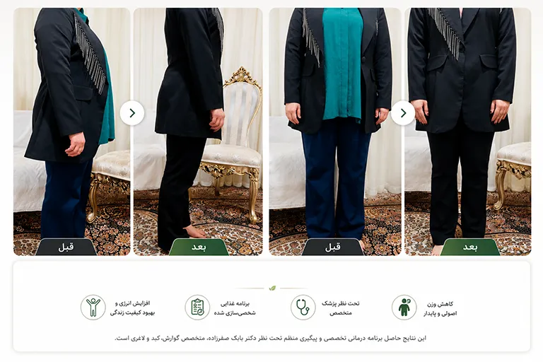 کاهش وزن با آمپول لاغری دکتر بابک صفر زاده