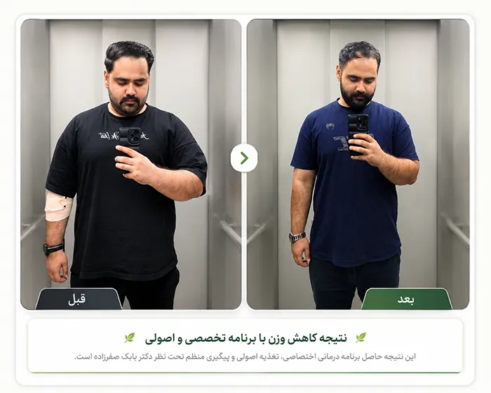 کاهش وزن با دکتر بابک صفرزاده